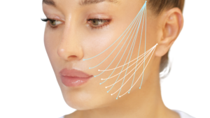 LIFTING NIĆMI APTOS KATOWICE MED-BEAUTY